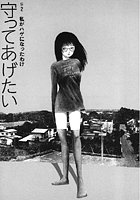 守ってあげたい（2）「守ってあげたい」＃2私がハゲになったわけ